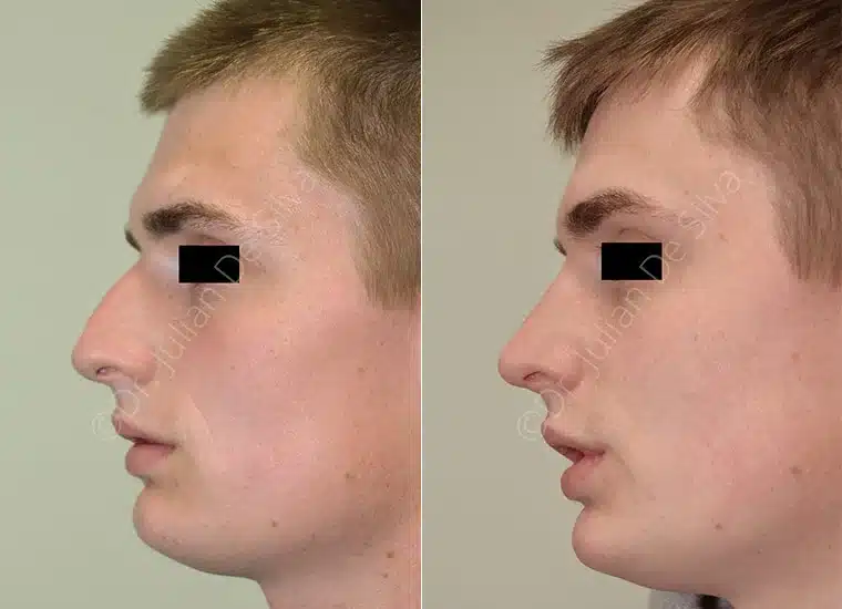 Cmp Gallery Slider image 4