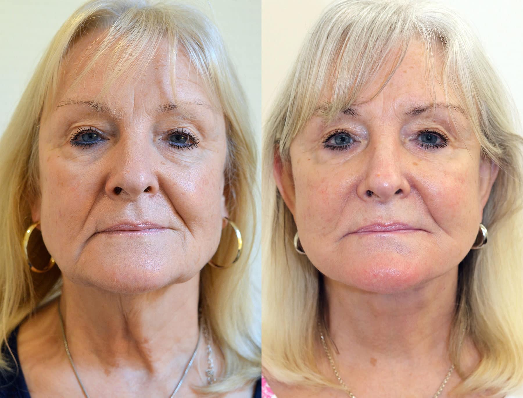 Cmp Gallery Slider image 5